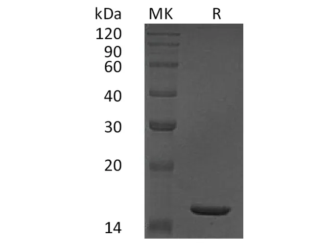 Recombinant Human TNF-alpha/TNFA Protein - image 1