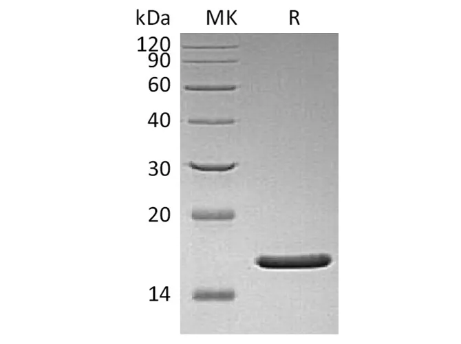 Recombinant Human FGF-2/FGF basic/FGFb Protein (aa 1-155)(Q65I,C96S,N111G) - image 1