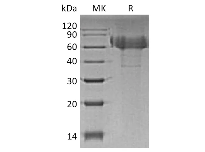 Recombinant Human TIM4/TIMD4 Protein (His Tag) - image 1