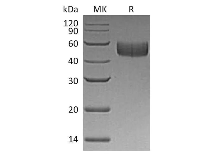 Recombinant Human SIRPB1/CD172b Protein (His Tag) - image 1