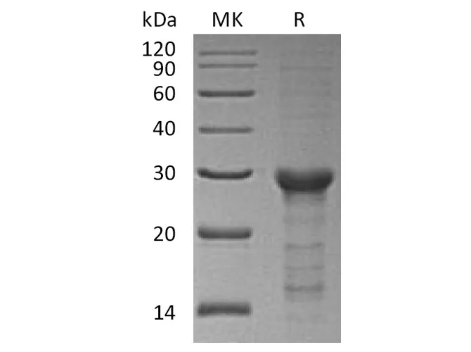 Recombinant Human STAT6 Protein (E.coli, His Tag) - image 1
