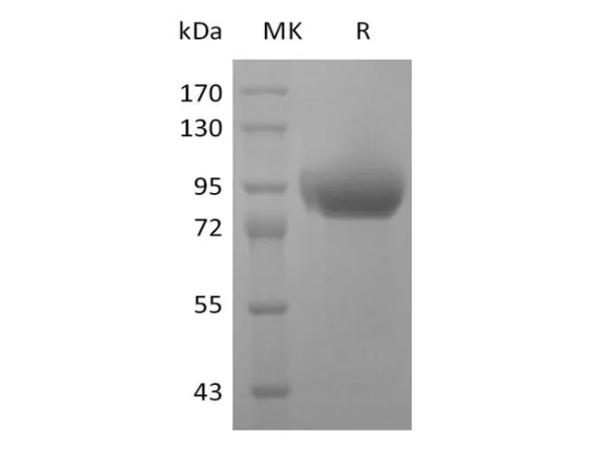 Recombinant Human SIGLEC5 Protein (His & Flag & Fc) - image 1