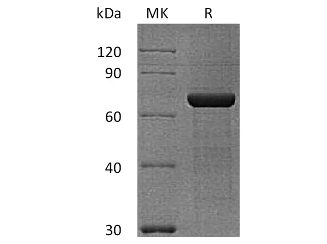 Recombinant Human Semaphorin 3A/SEMA3A Protein (His & Flag Tag) - image 1