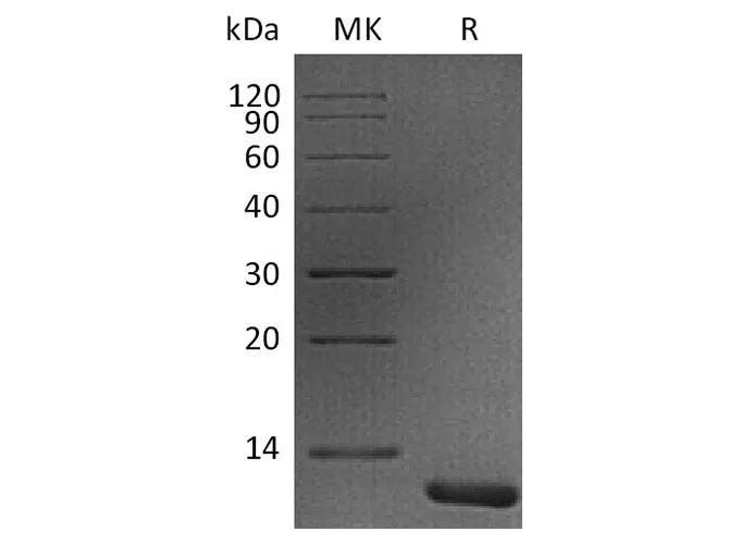 Recombinant Human S100A11 Protein - image 1