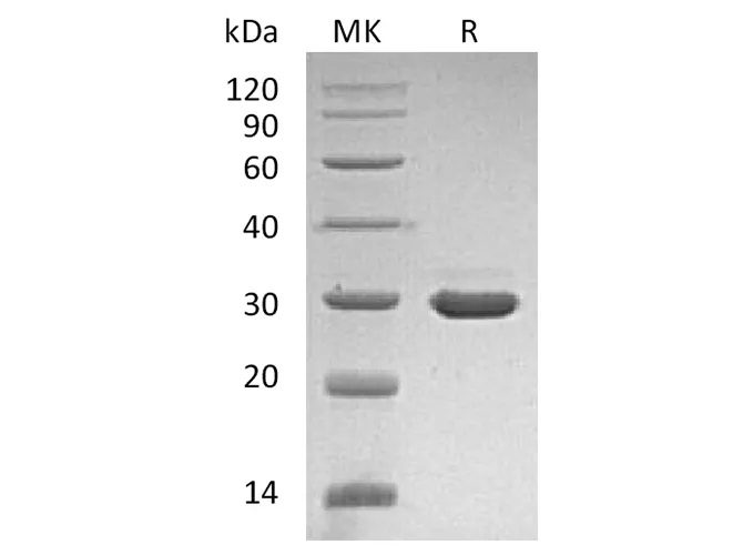 Recombinant Human β-NGF/NGFB Protein (with pro peptide) - image 1