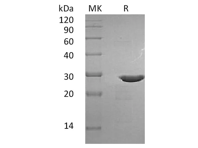 Recombinant Human BDNF Protein (with pro peptide) - image 1