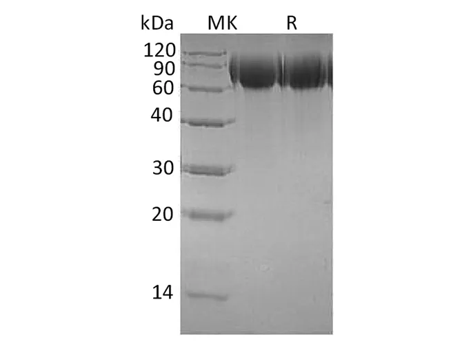 Recombinant Human TrkB/NTRK2 Protein (His Tag) - image 1
