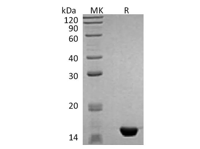 Recombinant Human MAP1LC3B Protein - image 1