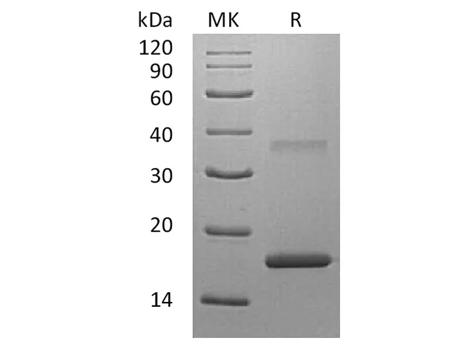 Recombinant Human Interleukin-7/IL-7 Protein - image 1