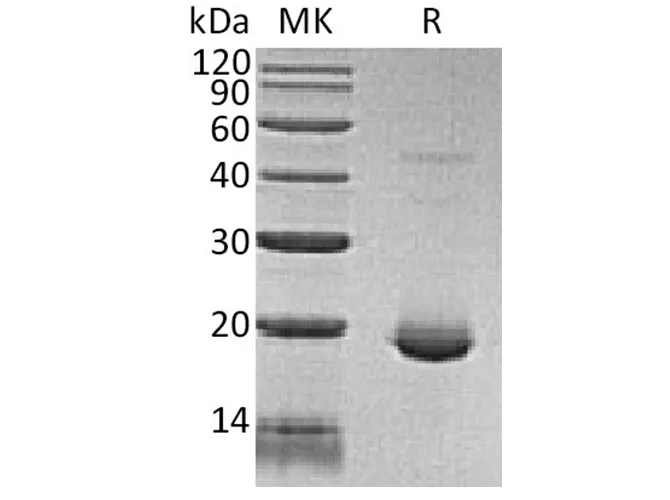 Recombinant Human IL-6/Interleukin-6 Protein - image 1