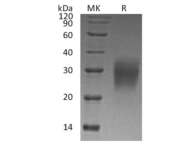 Recombinant Human Interleukin-22/IL-22 Protein - image 1