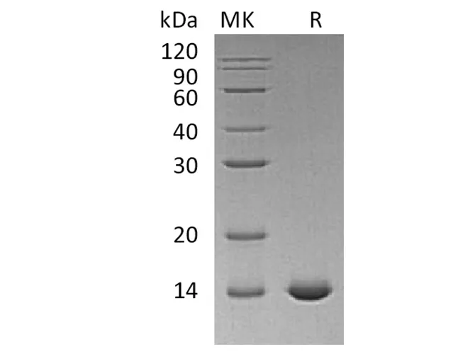 Recombinant Human Interleukin-2/IL-2 Protein (C145S) - image 1
