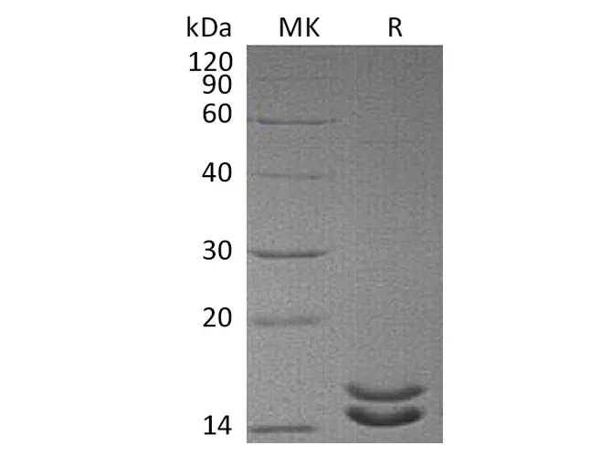 Recombinant Human Interleukin-2/IL-2 Protein (Mutant) - image 1