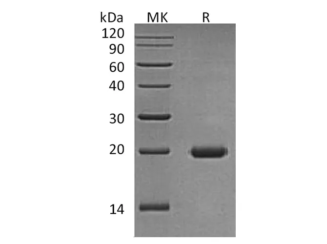 Recombinant Human Interleukin-17D/IL-17D Protein - image 1