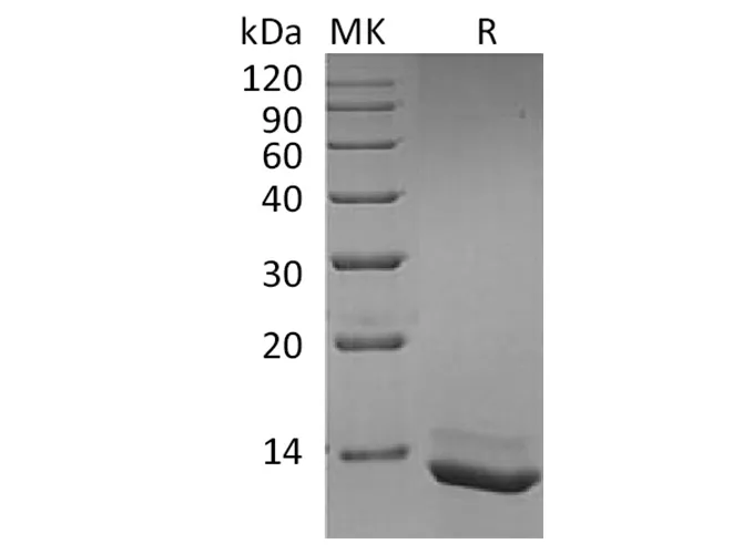 Recombinant Human Interleukin-15/IL-15 Protein - image 1