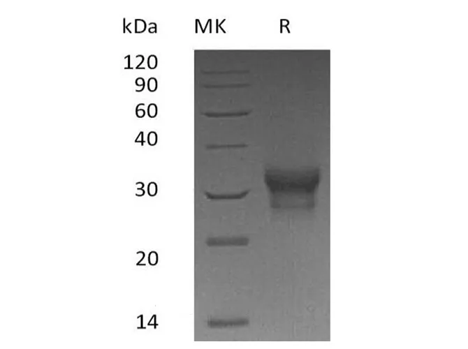 Recombinant Human IFN-λ1/IL-29 Protein (His Tag) - image 1