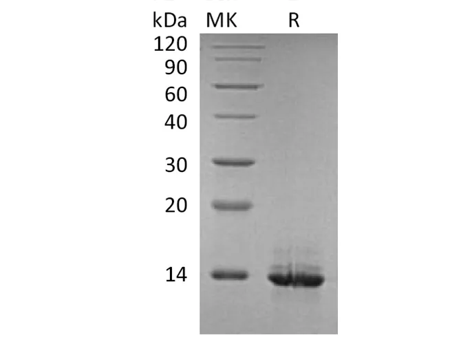 Recombinant Human HMGB1 Protein - image 1