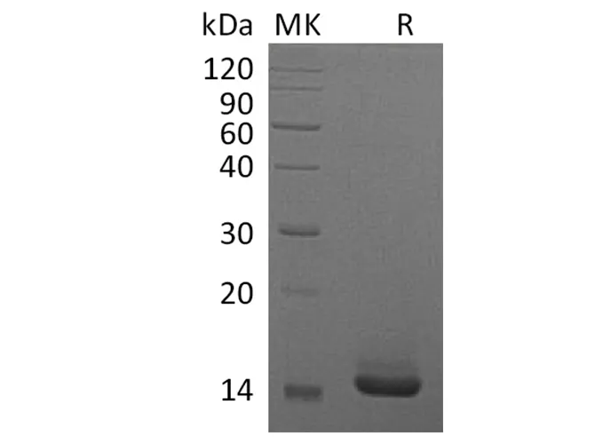 Recombinant Human GM-CSF/CSF2 Protein (E.coli) - image 1