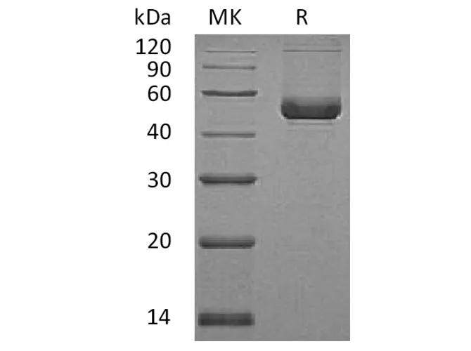 Recombinant Human SerpinE2/SERPINE2 Protein (His Tag) - image 1