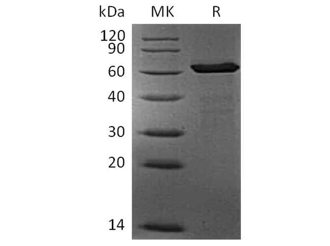 Recombinant Human FGL1 Protein (mFc Tag) - image 1