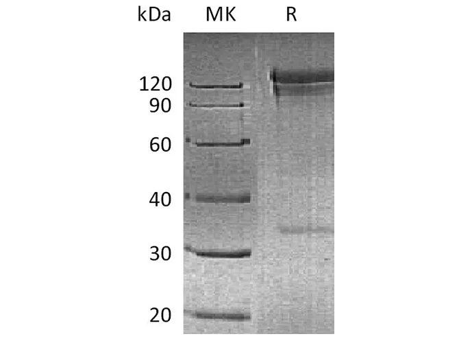 Recombinant Human DPP4/DPPIV/CD26 Protein (Fc Tag) - image 1