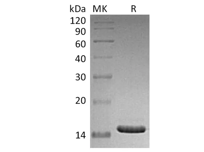 Recombinant Human CD40L/TNFSF5 Protein (E.coli) - image 1