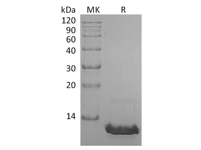 Recombinant Human CCL8/MCP-2 Protein - image 1