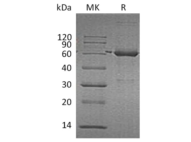 Recombinant Human Catalase/CAT Protein - image 1