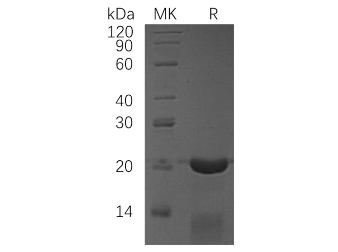 Recombinant Human CRADD/RAIDD Protein - image 1