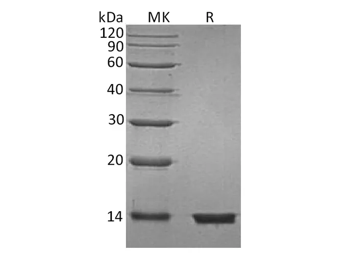 Recombinant Human Beta-2-Microglobulin/B2M Protein (His Tag) - image 1
