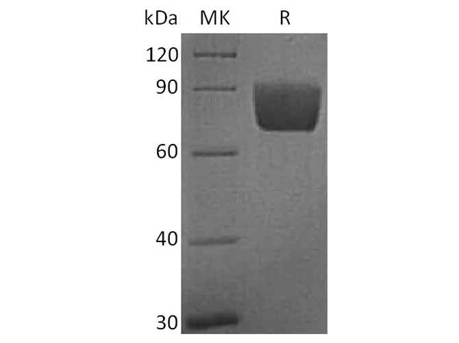 Recombinant Human B7-H4/VTCN1 Protein (Fc Tag) - image 1