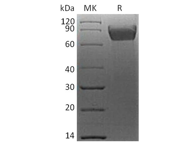 Recombinant Human B7-H4/VTCN1 Protein (mFc Tag) - image 1