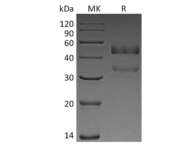 Recombinant Human ANGPTL7 Protein (His Tag) - image 1
