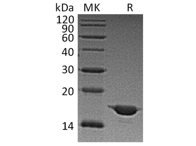 Recombinant Human Alpha-Synuclein/SNCA Protein - image 1