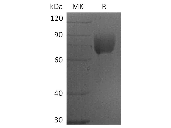 Recombinant Human CD80/B7-1 Protein (mFc Tag) - image 1