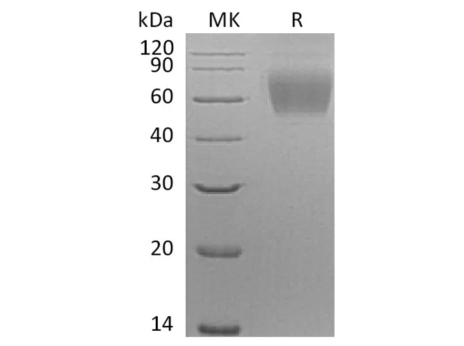 Recombinant Human SIGLEC9/CD329 Protein (His Tag) - image 1