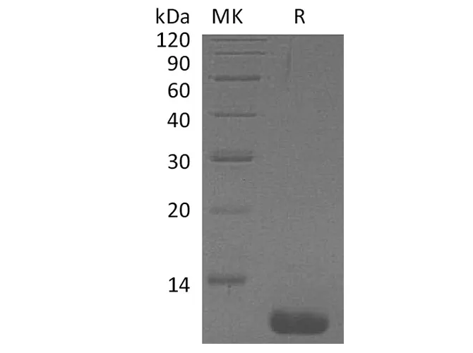 Recombinant Human CCL1/I-309 Protein - image 1
