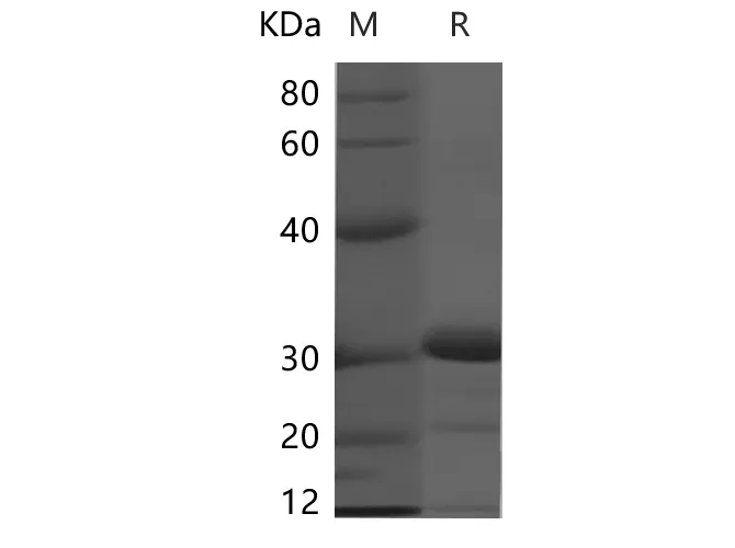 Recombinant Human KIM-1(C-6His) - image 1