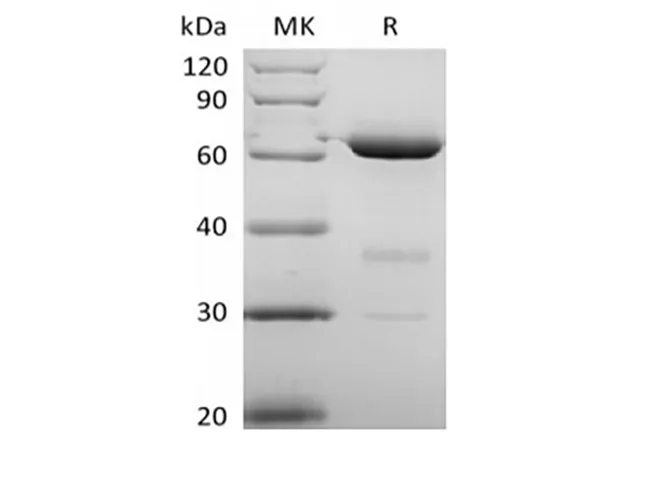 Recombinant Human 5'-Nucleotidase/5'-NT/CD73 (P21589, C-6His) - image 1