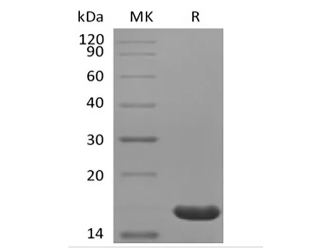 Recombinant Human IL-36 Beta/IL-1F8(153AA) - image 1