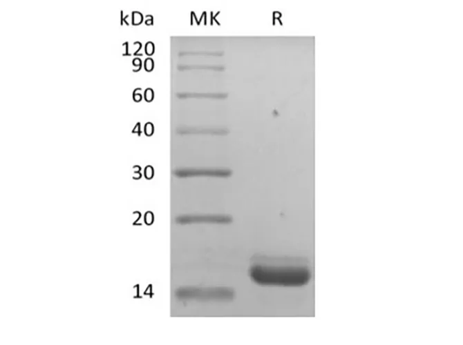 Recombinant Human IL-36 Receptor Antagonist Protein/IL-36RN/IL-1F5 - image 1