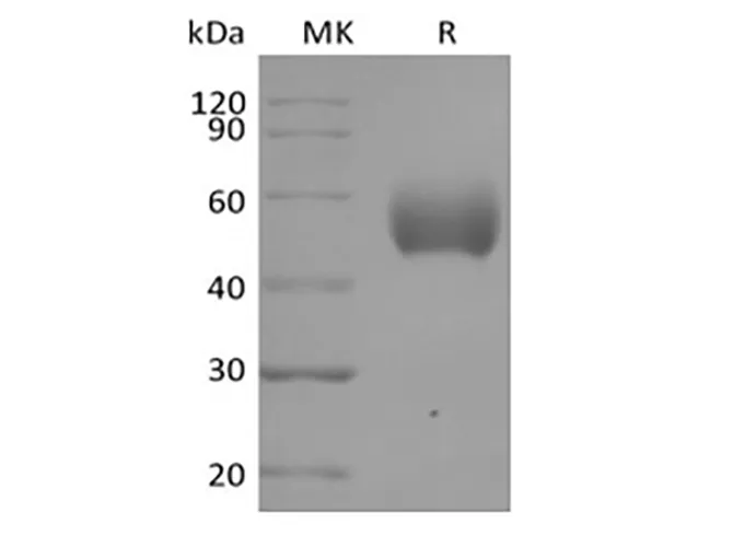 Recombinant Human Signal-Regulatory Protein alpha-1/SIRPA/CD172a (C-6His) - image 1