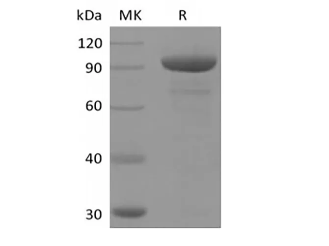 Recombinant Human 5'-Nucleotidase/5'-NT/CD73 (AAH65937.1, C-Fc) - image 1