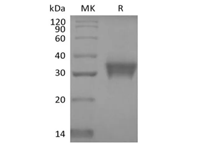 Recombinant Human Stanniocalcin 1/STC-1 (C-6His) - image 1