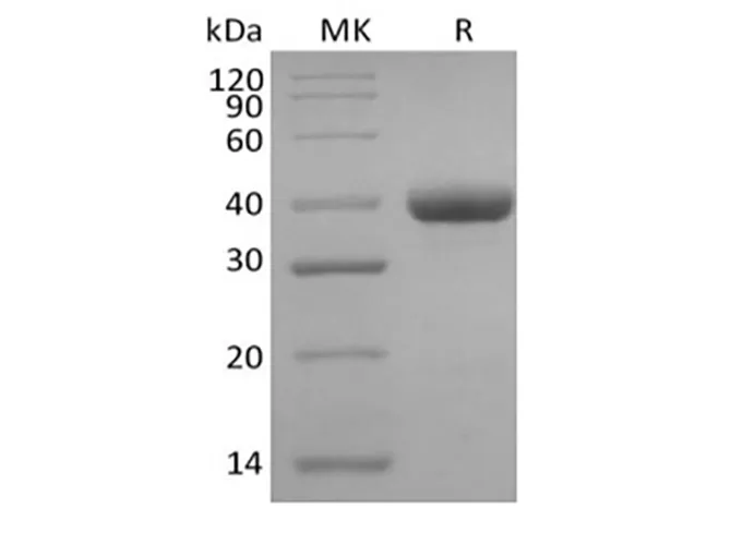 Recombinant Human IgG3 Fc - image 1