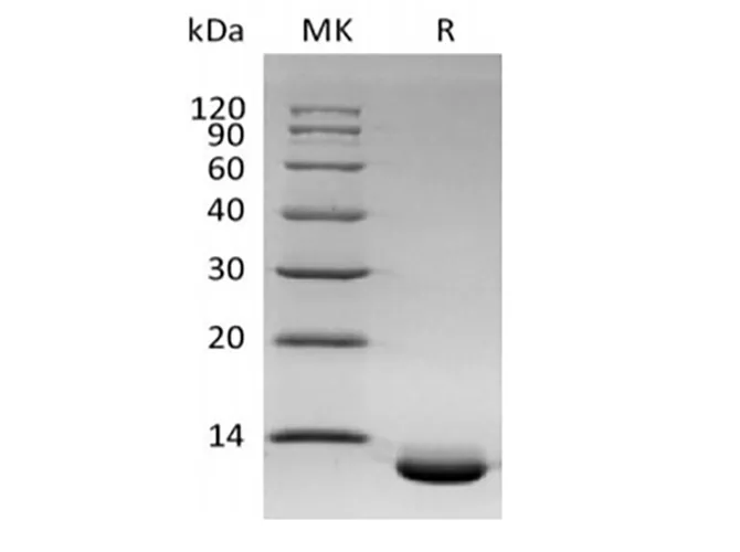 Recombinant Human C-X-C Motif Chemokine 6/CXCL6 (C-6His) - image 1