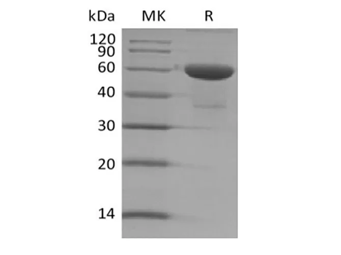Recombinant Human TMED1 (C-Fc) - image 1