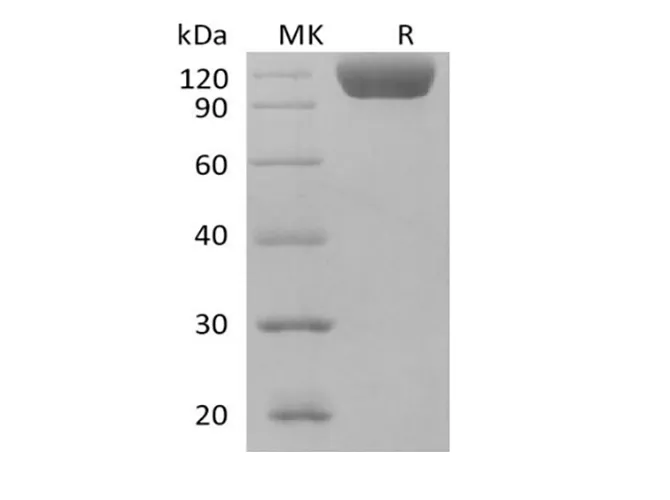 Recombinant Human Siglec-10 (C-Fc) - image 1