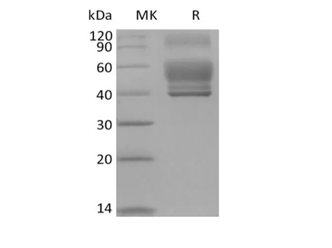 Recombinant Human Interleukin-13/IL-13 (C-Fc) - image 1