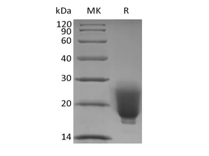 Recombinant Human/Mouse/Rat Irisin/FNDC5 (N-6His) - image 1